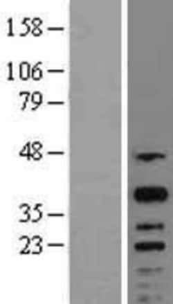 Novus Biologicals CREM Overexpression Lysate 0.1 mg | Buy Online | Novus Biologicals&trade; | Fisher Scientific