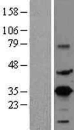 Novus Biologicals&trade;&nbsp;CREM Overexpression Lysate