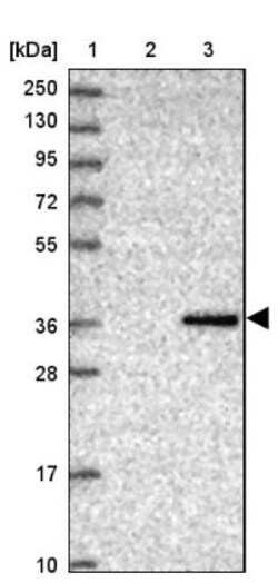 CRHBP Antibody, Novus Biologicals 25 &mu;L, Unconjugated:Antibodies, Polyclonal