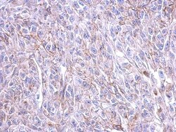 CRHR1/CRF1 Antibody, Novus Biologicals 0.1 mL | Buy Online | Novus Biologicals | Fisher Scientific