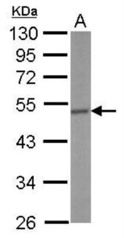 CRHR1/CRF1 Antibody, Novus Biologicals 0.1 mL | Buy Online | Novus Biologicals | Fisher Scientific