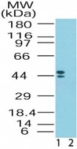 CRHR2/CRF2 Antibody, Novus Biologicals:Antibodies:Primary Antibodies