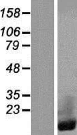 Novus Biologicals&trade;&nbsp;CRIP1 Overexpression Lysate