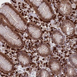 CRIP1 Antibody, Novus Biologicals 0.1mL; Unlabeled:Antibodies, Polyclonal