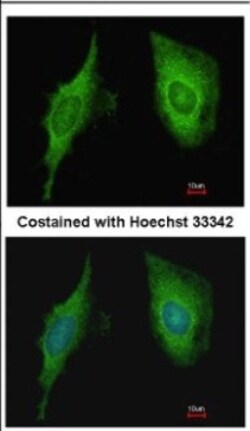 CRIP2 Antibody, Novus Biologicals 0.1mL; Unlabeled:Antibodies, Polyclonal