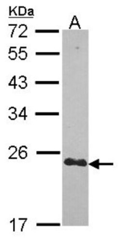 CRIP2 Antibody, Novus Biologicals 0.1mL; Unlabeled:Antibodies, Polyclonal