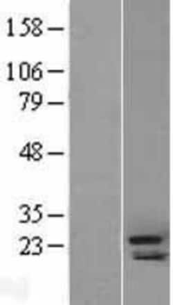 Novus Biologicals™ CRIPTO Overexpression Lysate