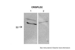 CRISPLD2 Antibody, Novus Biologicals 0.05mg; Unlabeled:Antibodies, Polyclonal