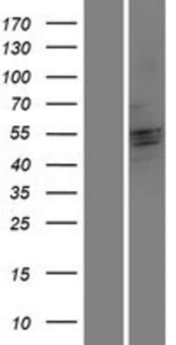 Novus Biologicals™ CRISPLD2 Overexpression Lysate