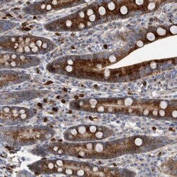 CRISPLD2 Antibody, Novus Biologicals 0.1mL; Unlabeled:Antibodies, Polyclonal