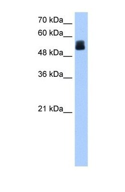 CRISPLD2 Antibody, Novus Biologicals 0.05mg; Unlabeled:Antibodies, Polyclonal