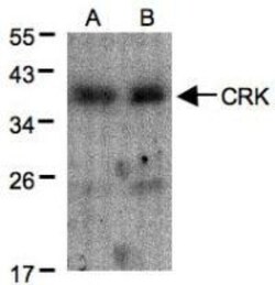 Crk Antibody, Novus Biologicals 0.1mg; Unlabeled:Antibodies, Polyclonal