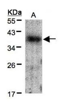 Crk Antibody, Novus Biologicals 0.1mg; Unlabeled:Antibodies, Polyclonal