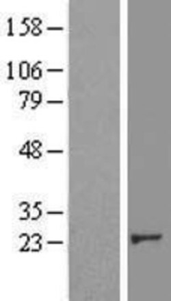 Novus Biologicals&trade;&nbsp;Crk Overexpression Lysate