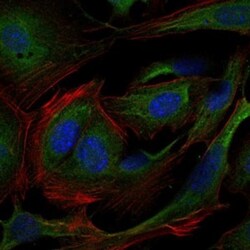 Crk Antibody (3G11E8), Novus Biologicals:Antibodies:Primary Antibodies