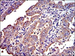 Crk Antibody (3G11E8), Novus Biologicals:Antibodies:Primary Antibodies