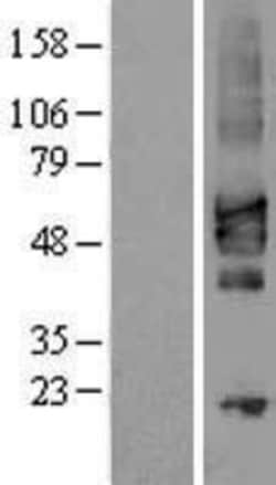 Novus Biologicals&trade;&nbsp;TSLPR/CRLF2 Overexpression Lysate