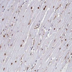 CRM1 Antibody, Novus Biologicals 0.1mL; Unlabeled:Antibodies, Polyclonal