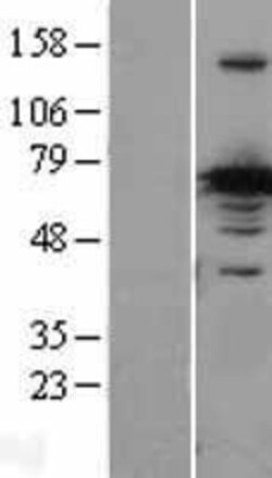 Novus Biologicals&trade;&nbsp;CRMP1 Overexpression Lysate