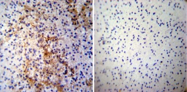 CRMP5 (CR-3) - 0.1 ML