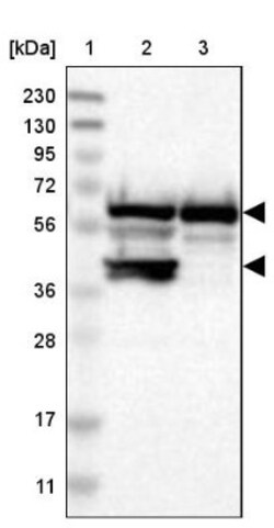 CROP Antibody, Novus Biologicals:Antibodies:Primary Antibodies