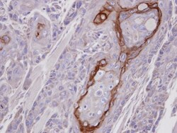 CROT Antibody, Novus Biologicals 100 &mu;L | Buy Online | Novus Biologicals | Fisher Scientific