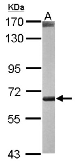 CROT Antibody, Novus Biologicals 100 &mu;L | Buy Online | Novus Biologicals | Fisher Scientific