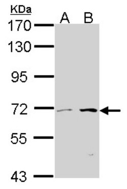 CROT Antibody, Novus Biologicals 100 &mu;L | Buy Online | Novus Biologicals | Fisher Scientific