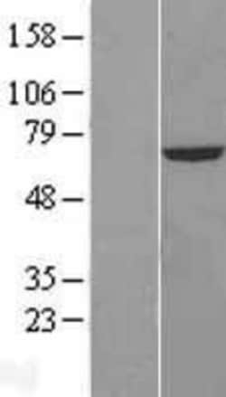 Novus Biologicals&trade;&nbsp;CROT Overexpression Lysate