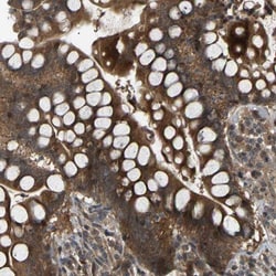 CROT Antibody, Novus Biologicals 0.1mL; Unlabeled:Antibodies, Polyclonal