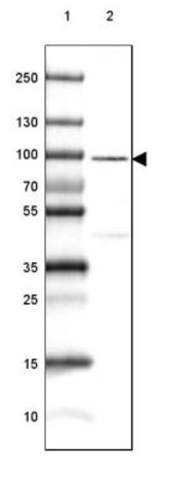 CRTAC1 Antibody, Novus Biologicals 0.1mL; Unlabeled:Antibodies, Polyclonal