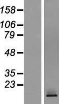 Novus Biologicals&trade;&nbsp;CRTAM Overexpression Lysate