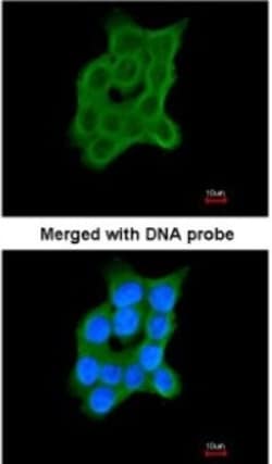 CRTAP Antibody, Novus Biologicals 0.1mL; Unlabeled:Antibodies, Polyclonal