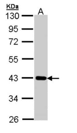 CRTAP Antibody, Novus Biologicals 0.1mL; Unlabeled:Antibodies, Polyclonal
