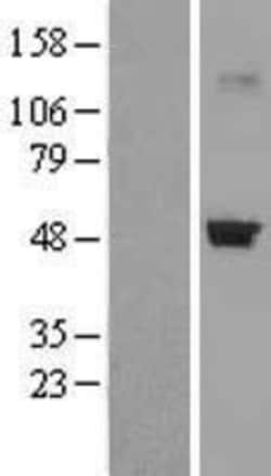 Novus Biologicals&trade;&nbsp;CRTAP Overexpression Lysate
