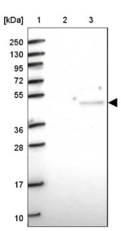 CRTAP Antibody, Novus Biologicals 0.1mL; Unlabeled:Antibodies, Polyclonal