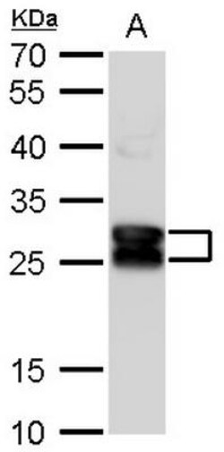CRYBA1 Antibody, Novus Biologicals 0.1mL; Unlabeled:Antibodies, Polyclonal