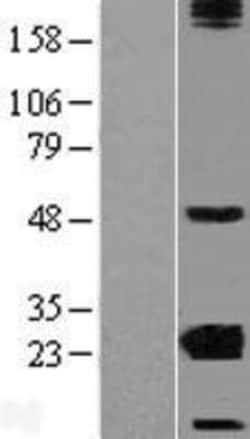 Novus Biologicals&trade;&nbsp;CRYBA2 Overexpression Lysate