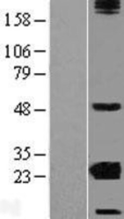 Novus Biologicals&trade;&nbsp;CRYBA2 Overexpression Lysate