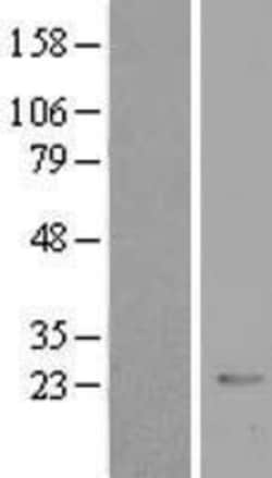 Novus Biologicals&trade;&nbsp;CRYBB2 Overexpression Lysate