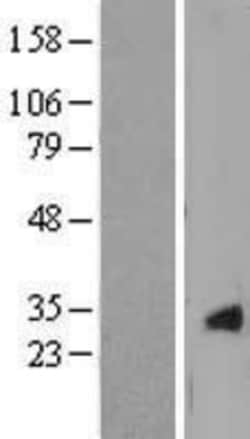 Novus Biologicals&trade;&nbsp;CRYGS Overexpression Lysate
