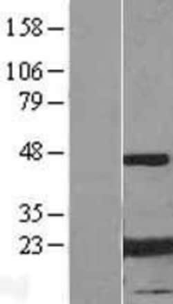 Novus Biologicals&trade;&nbsp;AlphaB Crystallin/CRYAB Overexpression Lysate