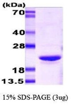 Novus Biologicals&trade;&nbsp;Recombinant Mouse AlphaB Crystallin/CRYAB Protein