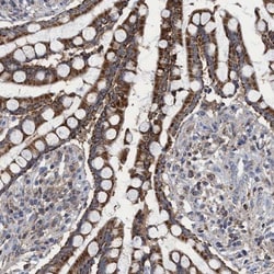 CRYZ Antibody, Novus Biologicals 0.1mL; Unlabeled:Antibodies, Polyclonal