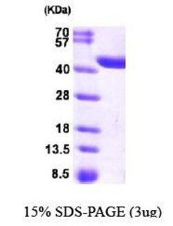 Novus Biologicals&trade;&nbsp;Recombinant Human CRYZL1 His Protein