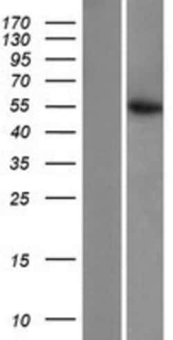 Novus Biologicals&trade;&nbsp;CS Citrate Synthase Overexpression Lysate