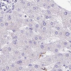 CSAP Antibody, Novus Biologicals:Antibodies:Primary Antibodies