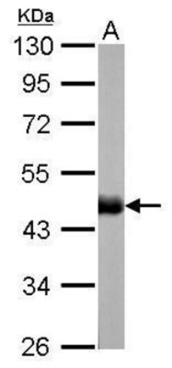 CS Citrate Synthase Antibody (1761), Novus Biologicals 0.1mL; Unlabeled:Antibodies