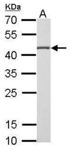 CS Citrate Synthase Antibody (1761), Novus Biologicals 0.1mL; Unlabeled:Antibodies