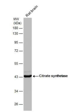 CS Citrate Synthase Antibody (1761), Novus Biologicals 0.1mL; Unlabeled:Antibodies